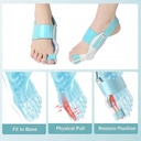 Correcteur Et Redresseur D'orteils Orthopédique 
